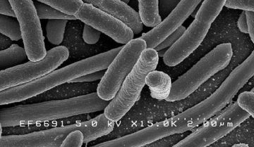 Scanning electron micrograph of Escherichia coli, grown in culture and adhered to a cover slip. wiki