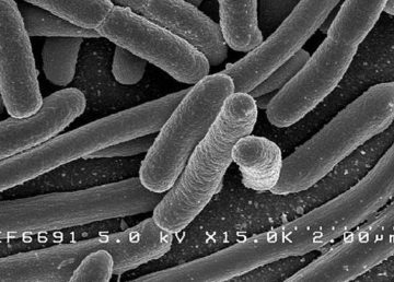 Scanning electron micrograph of Escherichia coli, grown in culture and adhered to a cover slip. wiki