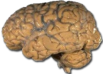 "Human brain NIH". Con licenza Pubblico dominio tramite Wikimedia Commons - https://commons.wikimedia.org/wiki/File:Human_brain_NIH.png#/media/File:Human_brain_NIH.png