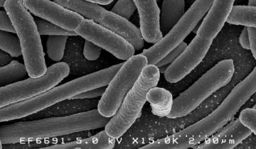 Escherichia coli: Scanning electron micrograph of Escherichia coli, grown in culture and adhered to a cover slip. Credit: Rocky Mountain Laboratories, NIAID, NIH – NIAID. Pubblico dominio, https://commons.wikimedia.org/w/index.php?curid=104228