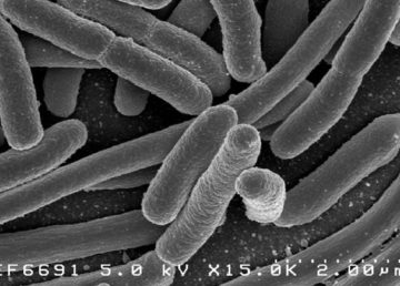 Escherichia coli: Scanning electron micrograph of Escherichia coli, grown in culture and adhered to a cover slip. Credit: Rocky Mountain Laboratories, NIAID, NIH – NIAID. Pubblico dominio, https://commons.wikimedia.org/w/index.php?curid=104228