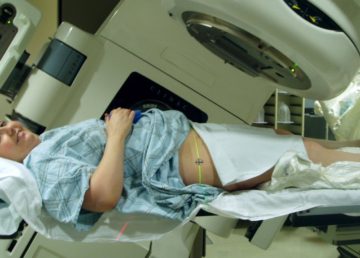 Una paziente si sottopone ad una seduta di radioterapia, effettuata per mezzo di un acceleratore lineare. Foto di Dina Wakulchik from Indianapolis, Indiana, USA - Zapping from a different angle..., CC BY 2.0, https://commons.wikimedia.org/w/index.php?curid=5784205