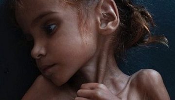 Amal Hussain (foto di Tyler Hicks)